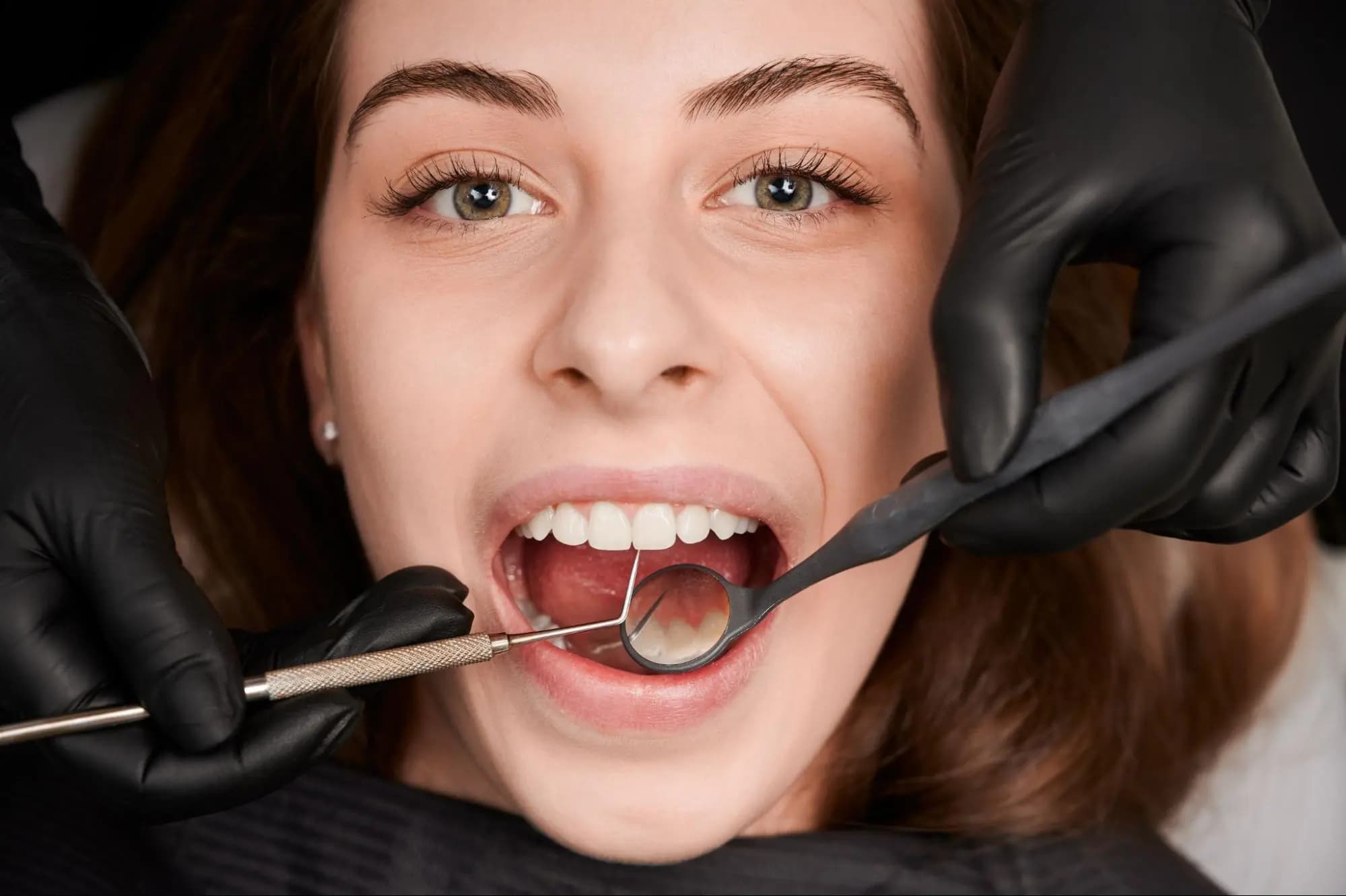 Root Canal Specialists at SmileKraft Dental Jersey City