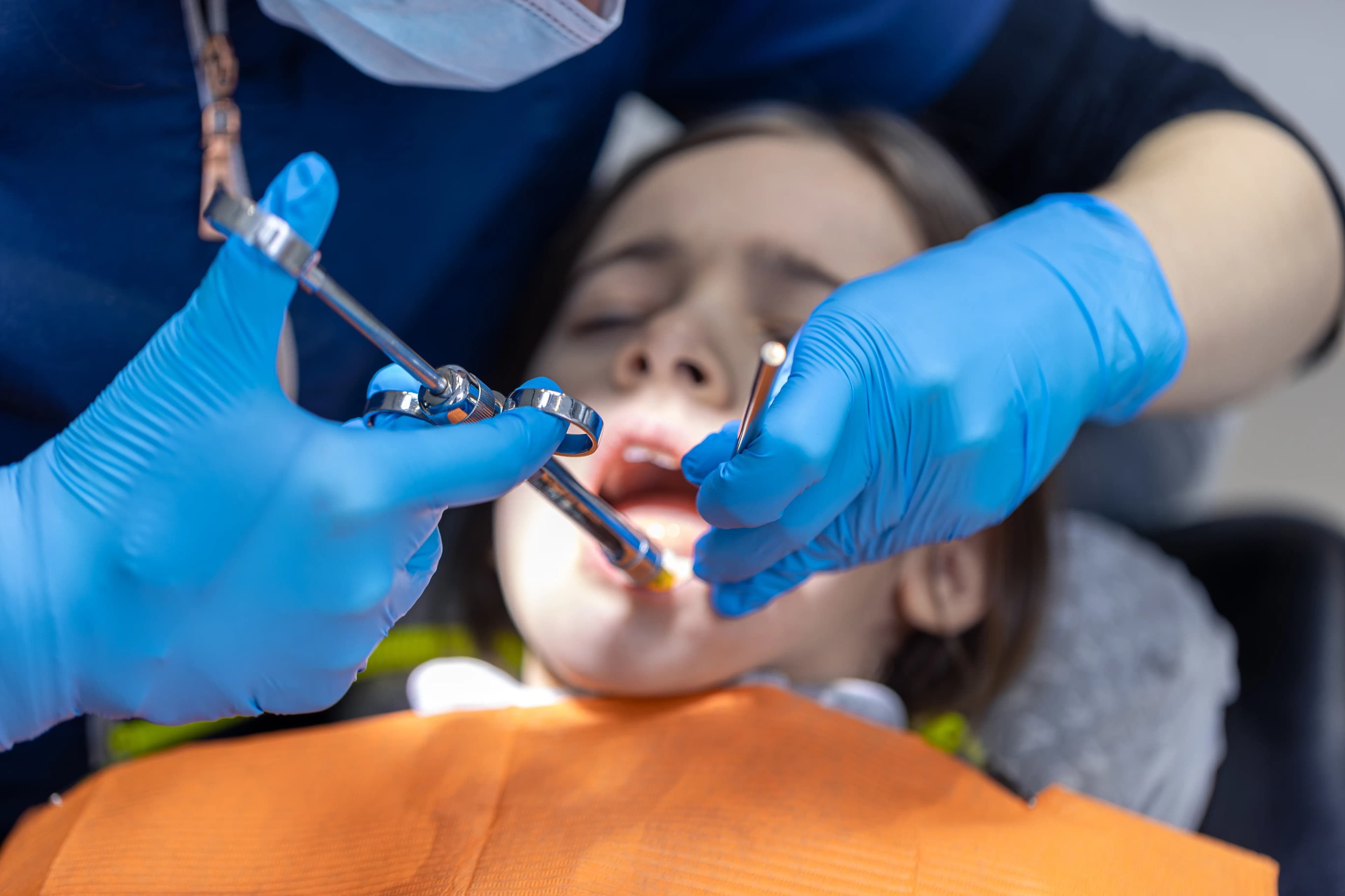 Tooth extractions at SmileKraft Dental Jersey City